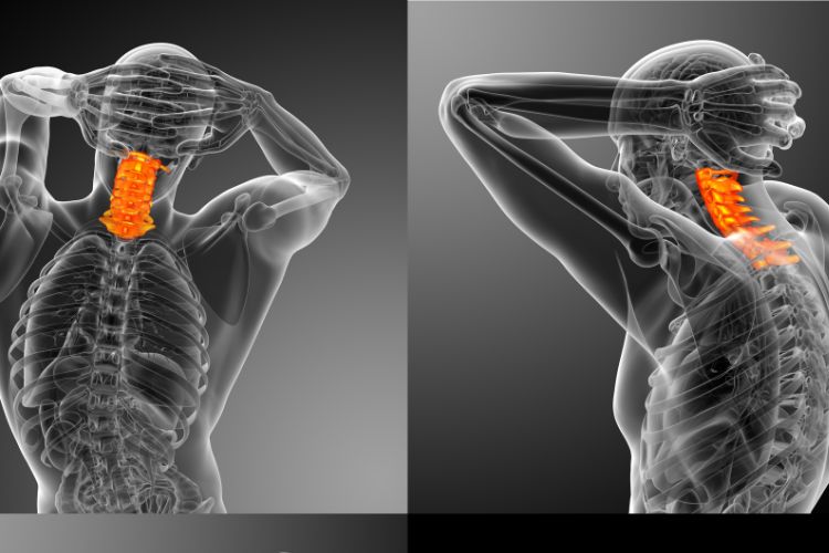 The Upper Cervical Spine and Its Importance